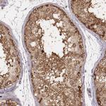 CARS Antibody in Immunohistochemistry (Paraffin) (IHC (P))