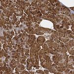 CARS Antibody in Immunohistochemistry (Paraffin) (IHC (P))