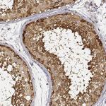 CARS Antibody in Immunohistochemistry (Paraffin) (IHC (P))