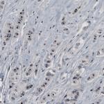 NOP56 Antibody in Immunohistochemistry (Paraffin) (IHC (P))