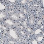 NOP56 Antibody in Immunohistochemistry (Paraffin) (IHC (P))