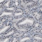 NOP56 Antibody in Immunohistochemistry (Paraffin) (IHC (P))