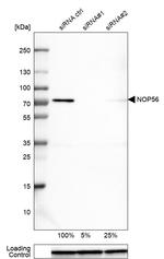 NOP56 Antibody