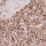 VGAT Antibody in Immunohistochemistry (IHC)