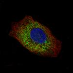 Laminin gamma-2 Antibody in Immunocytochemistry (ICC/IF)