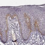 Laminin gamma-2 Antibody in Immunohistochemistry (IHC)