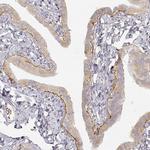 Laminin gamma-2 Antibody in Immunohistochemistry (IHC)