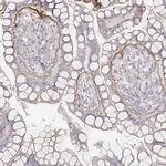 Laminin gamma-2 Antibody in Immunohistochemistry (IHC)