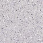 Laminin gamma-2 Antibody in Immunohistochemistry (IHC)