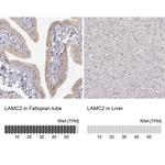 Laminin gamma-2 Antibody