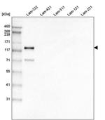 Laminin gamma-2 Antibody in Western Blot (WB)