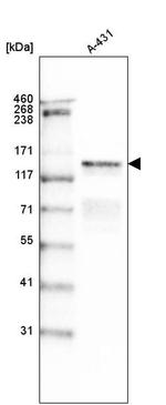 Laminin gamma-2 Antibody in Western Blot (WB)