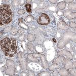 Laminin alpha-5 Antibody in Immunohistochemistry (IHC)