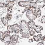 Laminin alpha-5 Antibody in Immunohistochemistry (IHC)