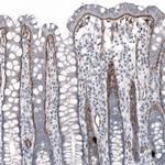 Laminin alpha-5 Antibody in Immunohistochemistry (IHC)