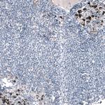 Laminin alpha-5 Antibody in Immunohistochemistry (IHC)