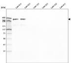 Laminin alpha-5 Antibody in Western Blot (WB)