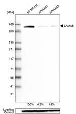 Laminin alpha-5 Antibody in Western Blot (WB)