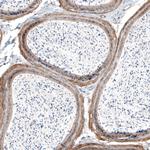 Laminin alpha-4 Antibody in Immunohistochemistry (Paraffin) (IHC (P))