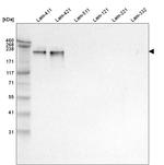 Laminin alpha-4 Antibody in Western Blot (WB)