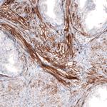 Laminin alpha-4 Antibody in Immunohistochemistry (Paraffin) (IHC (P))