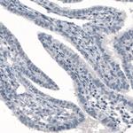 PGM1 Antibody in Immunohistochemistry (Paraffin) (IHC (P))