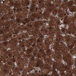 PGM1 Antibody in Immunohistochemistry (Paraffin) (IHC (P))