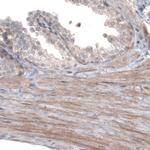 PGM1 Antibody in Immunohistochemistry (Paraffin) (IHC (P))