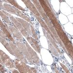 PGM1 Antibody in Immunohistochemistry (Paraffin) (IHC (P))