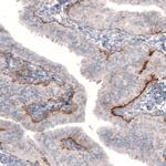 Laminin beta-3 Antibody in Immunohistochemistry (Paraffin) (IHC (P))