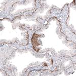 Laminin beta-3 Antibody in Immunohistochemistry (Paraffin) (IHC (P))