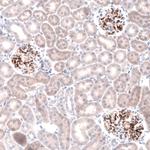 Laminin beta-3 Antibody in Immunohistochemistry (Paraffin) (IHC (P))