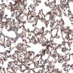 Laminin beta-3 Antibody in Immunohistochemistry (Paraffin) (IHC (P))