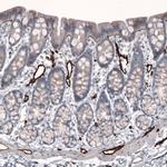 Laminin beta-3 Antibody in Immunohistochemistry (Paraffin) (IHC (P))