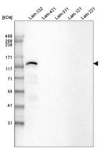 Laminin beta-3 Antibody in Western Blot (WB)