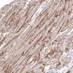 Laminin alpha-2 Antibody in Immunohistochemistry (IHC)