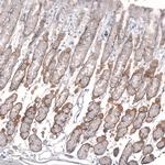 Laminin alpha-2 Antibody in Immunohistochemistry (IHC)