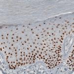 TLE3 Antibody in Immunohistochemistry (Paraffin) (IHC (P))