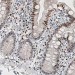 TLE3 Antibody in Immunohistochemistry (Paraffin) (IHC (P))