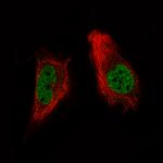 ARID1A Antibody in Immunocytochemistry (ICC/IF)