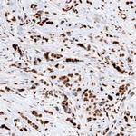 ARID1A Antibody in Immunohistochemistry (Paraffin) (IHC (P))