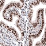 ARID1A Antibody in Immunohistochemistry (Paraffin) (IHC (P))