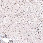 ARID1A Antibody in Immunohistochemistry (Paraffin) (IHC (P))