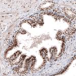 ARID1A Antibody in Immunohistochemistry (Paraffin) (IHC (P))