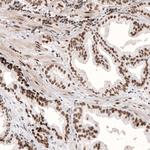 ARID1A Antibody in Immunohistochemistry (Paraffin) (IHC (P))