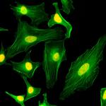 Histone Macro-H2A.1 Antibody in Immunocytochemistry (ICC/IF)