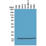 Histone H2B Antibody in Western Blot (WB)