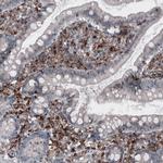 VISTA Antibody in Immunohistochemistry (IHC)