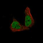 METTL14 Antibody in Immunocytochemistry (ICC/IF)