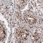 METTL14 Antibody in Immunohistochemistry (IHC)